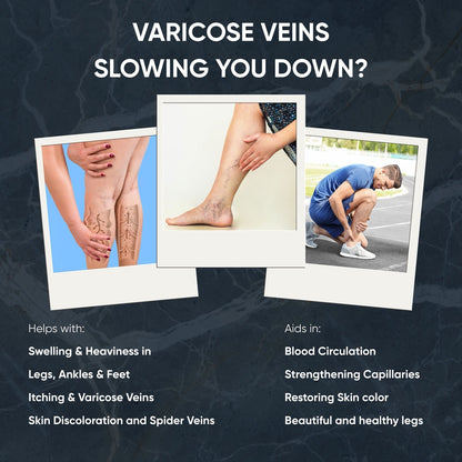 PENIKOSETE®️ Ayurvedic Advanced Vein Care Kit to Reduce Varicose Veins & Boost Circulation with 60 Easy-to-Swallow Ayurvedic Tablets of Ashwagandha, Punarnava, Turmeric & Triphala